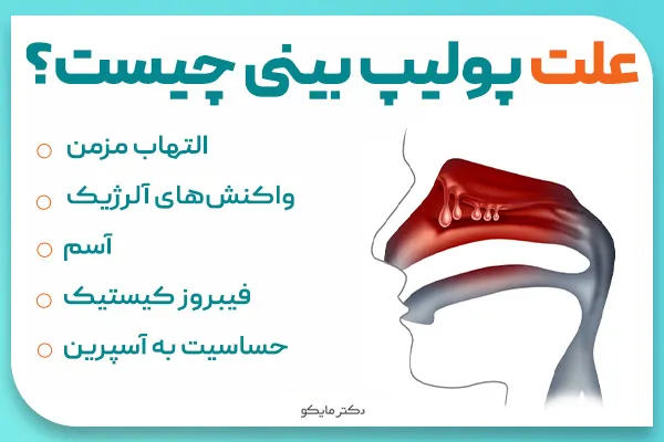 علت پولیپ بینی
