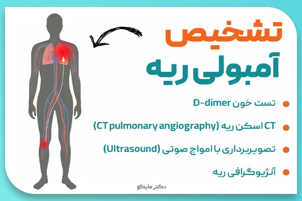 تشخیص آمبولی ریه
