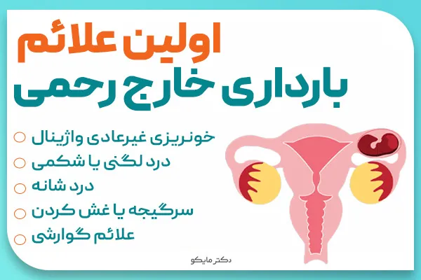 اولین علائم بارداری خارج از رحم