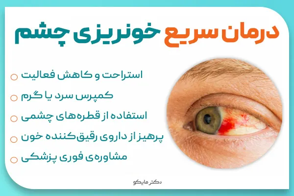 درمان سریع خونریزی چشم