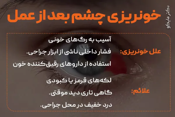 خونریزی چشم بعد از عمل