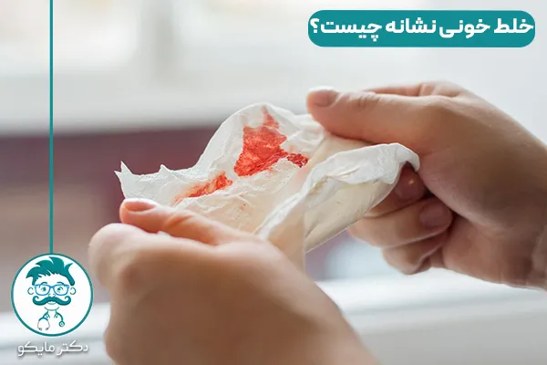 خلط خونی بینی