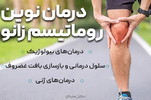 درمانهای نوین روماتیسم زانو