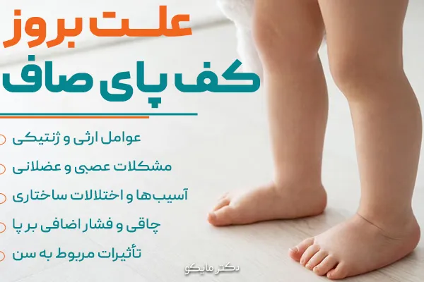 علت بروز کف پای صاف