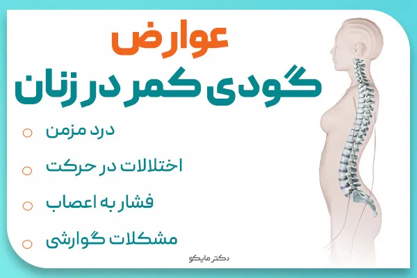 عوارض گودی کمر در زنان