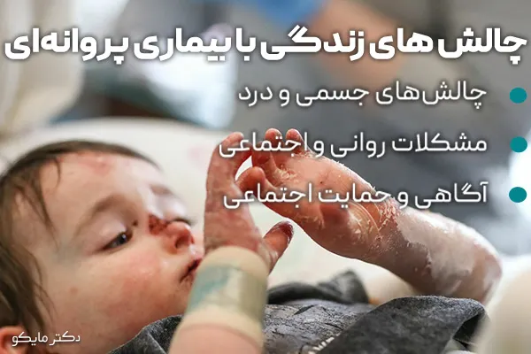 چالشهای زندگی با بیماری پروانه ای