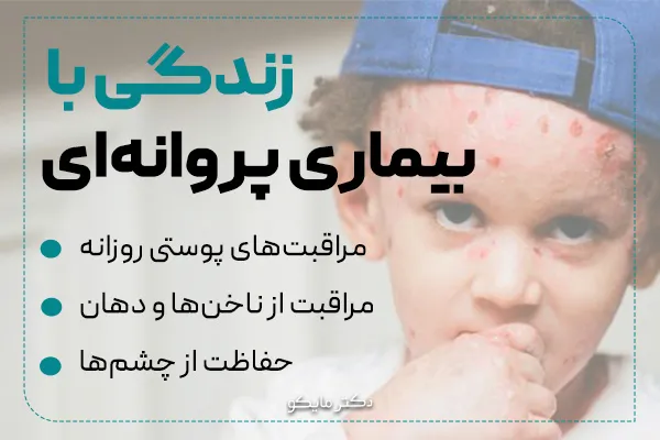 زندگی با بیماری پروانهای