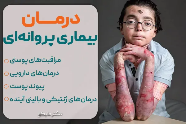 درمان بیماری پروانهای
