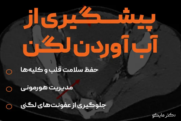 پیشگیری از تجمع مایع آزاد در لگن