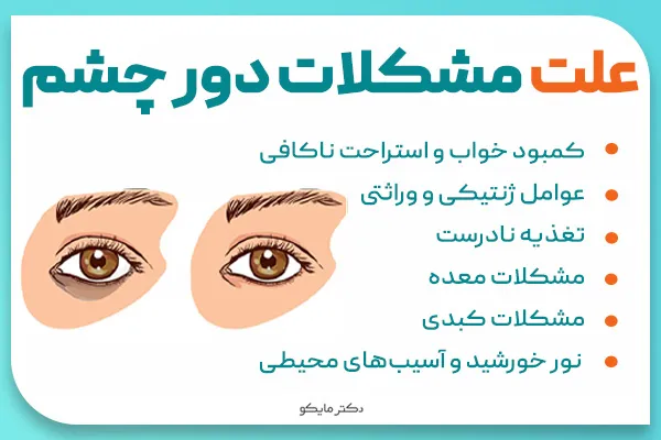 علت مشکلات دور چشم چیست؟