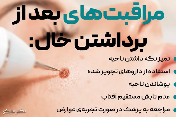 مراقبتهای بعد از خال برداری
