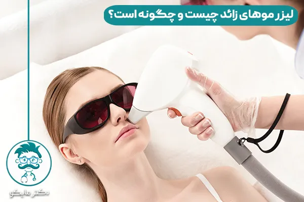 لیزر موهای زائد بدن چیست و چگونه است؟
