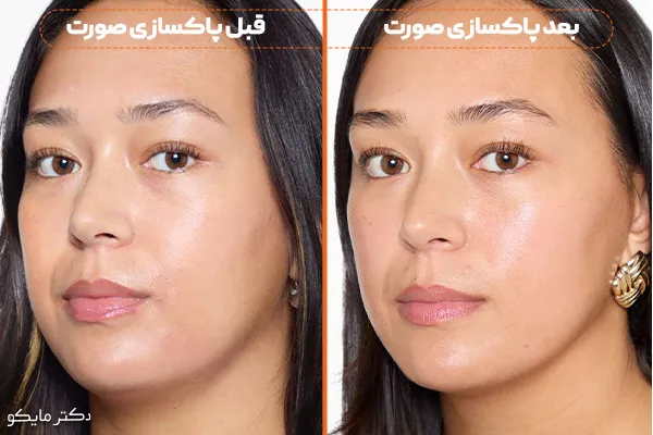 قیمت پاکسازی صورت در آرایشگاه