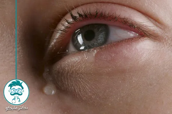 علت اشک آمدن از چشم