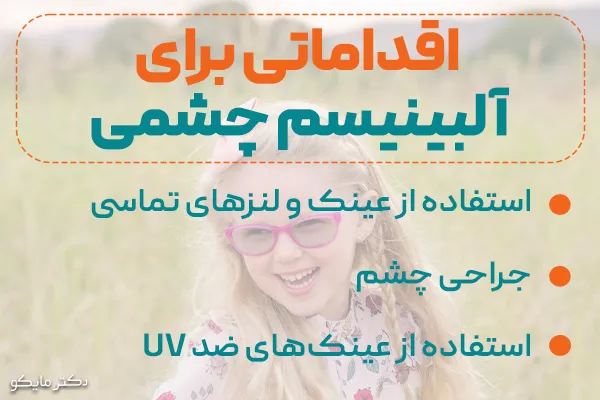 درمان آلبینیسم چشمی