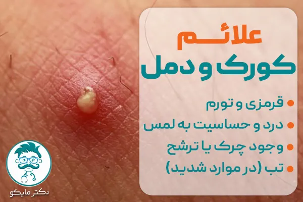 علائم بیماری کورک و دمل