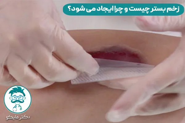 زخم بستر چیست؟