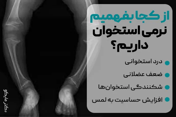 از کجا بفهمیم نرمی استخوان داریم؟