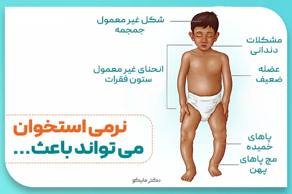 نرمی استخوان چگونه است؟