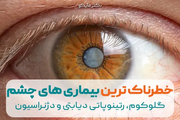 خطرناک ترین بیماری های چشمی