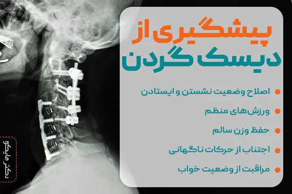 پیشگیری از دیسک گردن