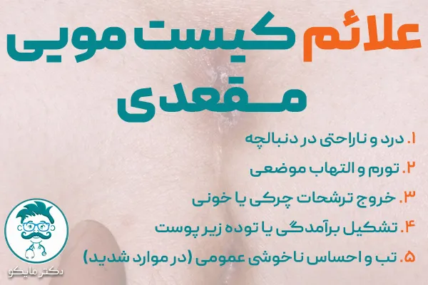 علائم کیست مویی مقعدی