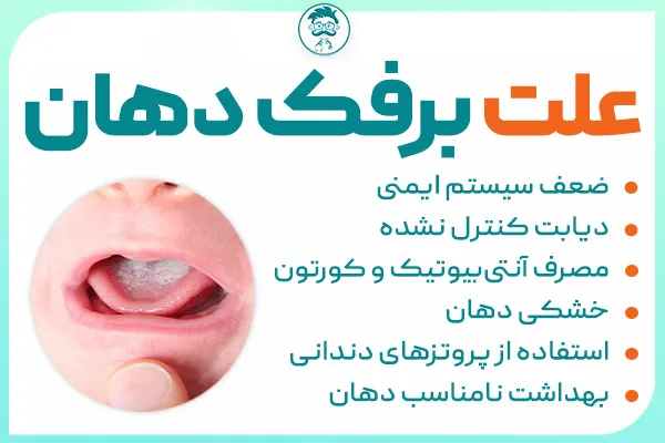 علت برفک دهان چیست؟