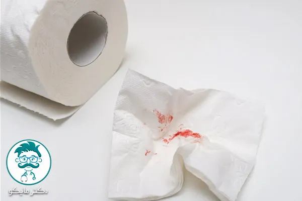 علائم فیشر مقعدی