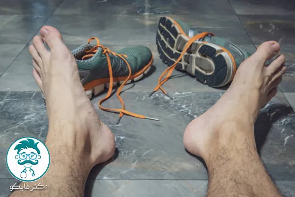 تعریق زیاد بدن