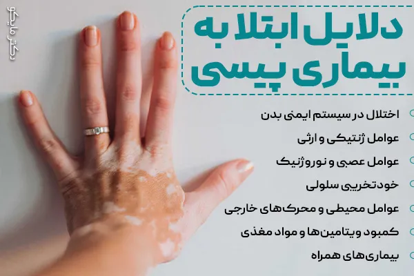 دلایل ابتلا به بیماری پیسی چیست؟