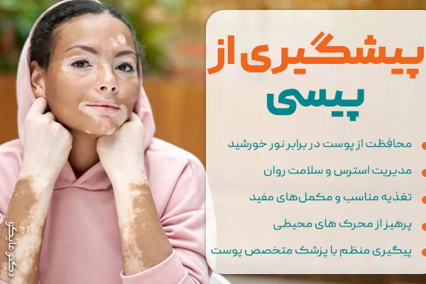پیشگیری از پیسی یا برص