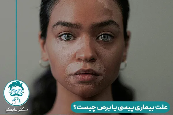 بیماری پیسی چیست؟