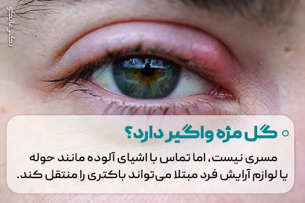 گل مژه واگیر دارد؟