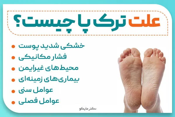 علت ترک پاشنه پا چیست؟